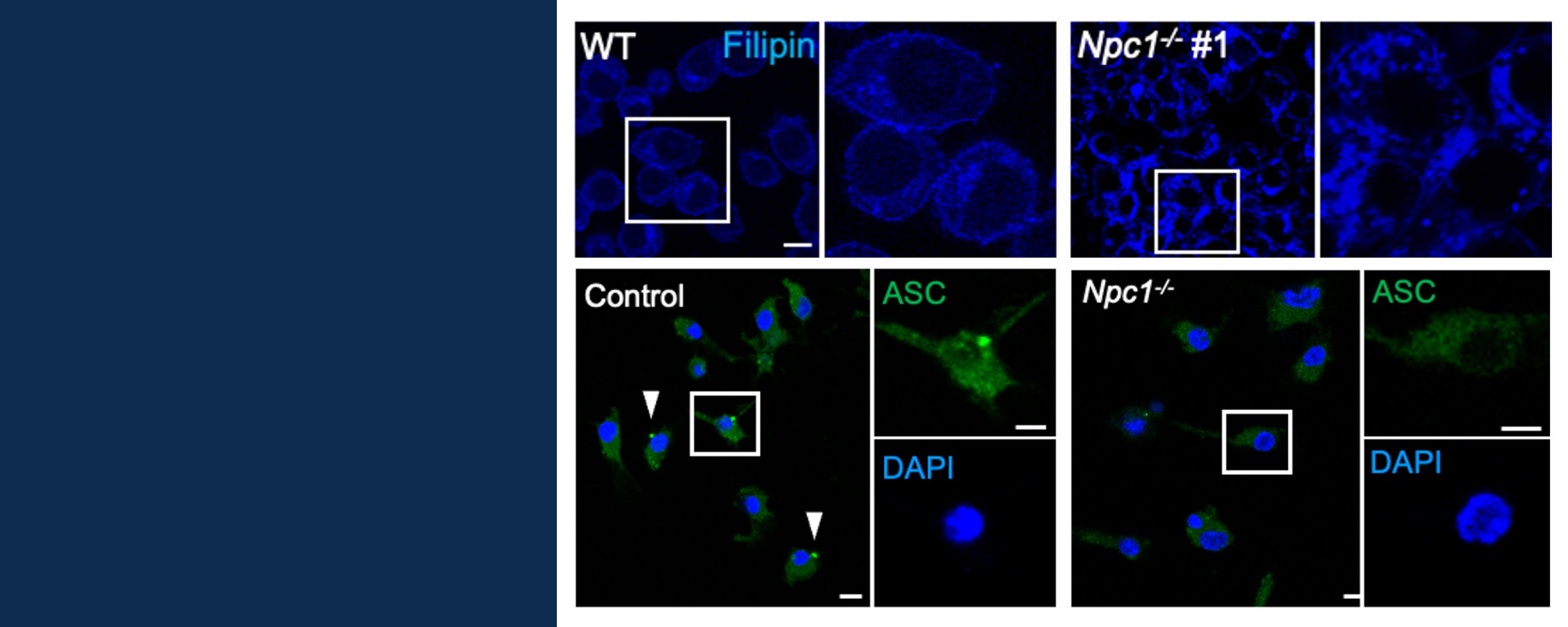 [Describe image: e.g. confocal image of ASC specks in macrophages]